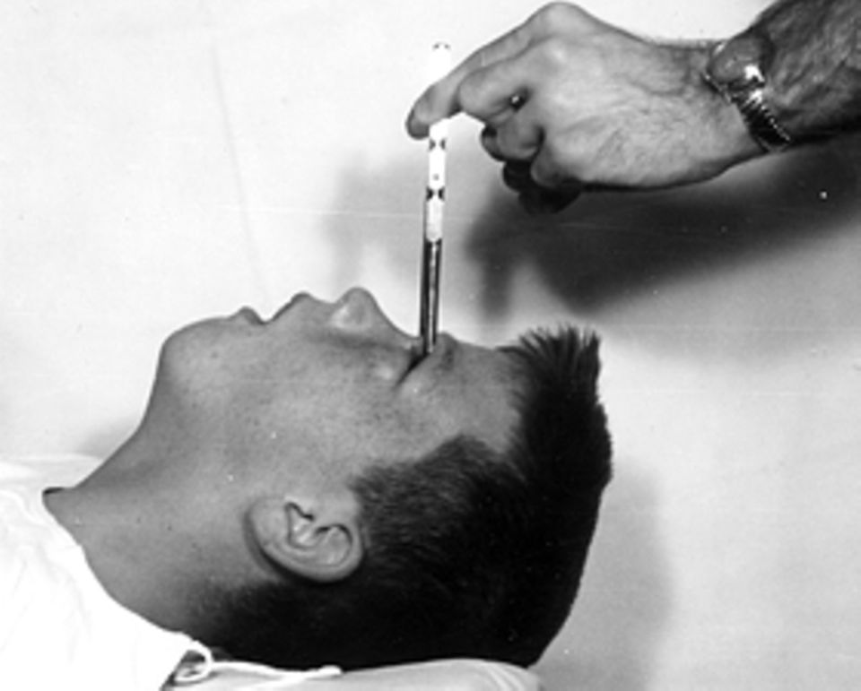 Tiefe Schnitte ins Gehirn sollen am 16. Dezember 1960 den zwölfjährigen Howard Dully von einer angeblichen Schizophrenie heilen