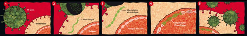 Aids: Ein HI-Virus hat winzige Noppen auf seiner Oberfläche, kleine "Schlüssel", mit denen es ganz bestimmte Zellen aufschließen kann, in der Grafik etwa eine T-Helferzelle 1. Hat es solch eine Zelle erkannt, dockt das Virus an und verschmilzt damit. Gleichzeitig schleust es sein Erbgut, also seinen Bauplan, in die Zelle ein 2. Bloß: Dieser Bauplan ist in einer Sprache geschrieben, mit der die Zelle nichts anfangen kann. Darum wird der Bauplan nun in eine verständliche Sprache übersetzt 3. Und genau diese Übersetzung wird im nächsten Schritt in das Erbgut im Zellkern der Zelle eingebaut 4. Danach läuft in der Zelle alles nur noch nach dem Plan des Virus ab. Und das bedeutet: Die Zelle produziert ständig neue Viren 5 , bis sie am Schluss selbst daran zugrunde geht. Aids: Ein HI-Virus hat winzige Noppen auf seiner Oberfläche, kleine "Schlüssel", mit denen es ganz bestimmte Zellen aufschließen kann, in der Grafik etwa eine T-Helferzelle 1. Hat es solch eine Zelle erkannt, dockt das Virus an und verschmilzt damit. Gleichzeitig schleust es sein Erbgut, also seinen Bauplan, in die Zelle ein 2. Bloß: Dieser Bauplan ist in einer Sprache geschrieben, mit der die Zelle nichts anfangen kann. Darum wird der Bauplan nun in eine verständliche Sprache übersetzt 3. Und genau diese Übersetzung wird im nächsten Schritt in das Erbgut im Zellkern der Zelle eingebaut 4. Danach läuft in der Zelle alles nur noch nach dem Plan des Virus ab. Und das bedeutet: Die Zelle produziert ständig neue Viren 5 , bis sie am Schluss selbst daran zugrunde geht.