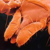 Fotoshow: Zecken - Bild 3