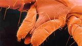 Fotoshow: Zecken - Bild 3