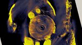 Der Mechanismus von Antikythera - Bild 5