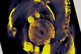 Der Mechanismus von Antikythera - Bild 5