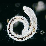 Hygiene: Der Zoo in der Wasserleitung