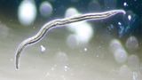 Hygiene: Der Zoo in der Wasserleitung - Bild 2