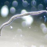 Hygiene: Der Zoo in der Wasserleitung - Bild 2