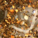 Hygiene: Der Zoo in der Wasserleitung - Bild 4