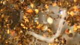 Hygiene: Der Zoo in der Wasserleitung - Bild 4