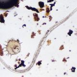 Hygiene: Der Zoo in der Wasserleitung - Bild 5