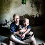 UNICEF-Foto des Jahres 2009 - Bild 2