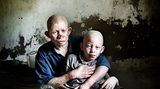 UNICEF-Foto des Jahres 2009 - Bild 2
