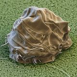 Bärtierchen: Überlebenskünstler