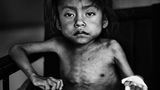 Unicef-Foto des Jahres