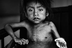 Unicef-Foto des Jahres