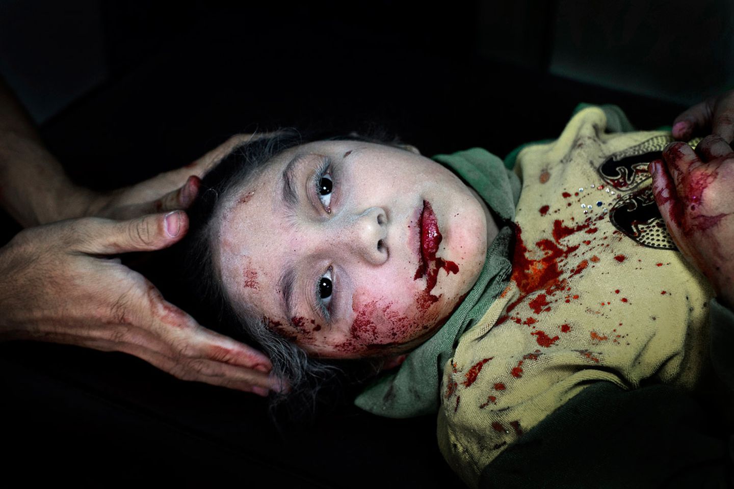 Das Unicef-Foto des Jahres: Das Gesicht des Krieges