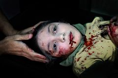 Unicef-Foto des Jahres