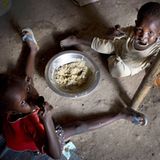 UNICEF: Fotostrecke: Hunger im Südsudan