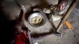 UNICEF: Fotostrecke: Hunger im Südsudan