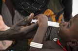 UNICEF: Fotostrecke: Hunger im Südsudan - Bild 10