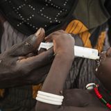 UNICEF: Fotostrecke: Hunger im Südsudan - Bild 10