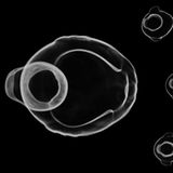 Röntgen: Röntgenstrahlung: Voller Durchblick - Bild 2