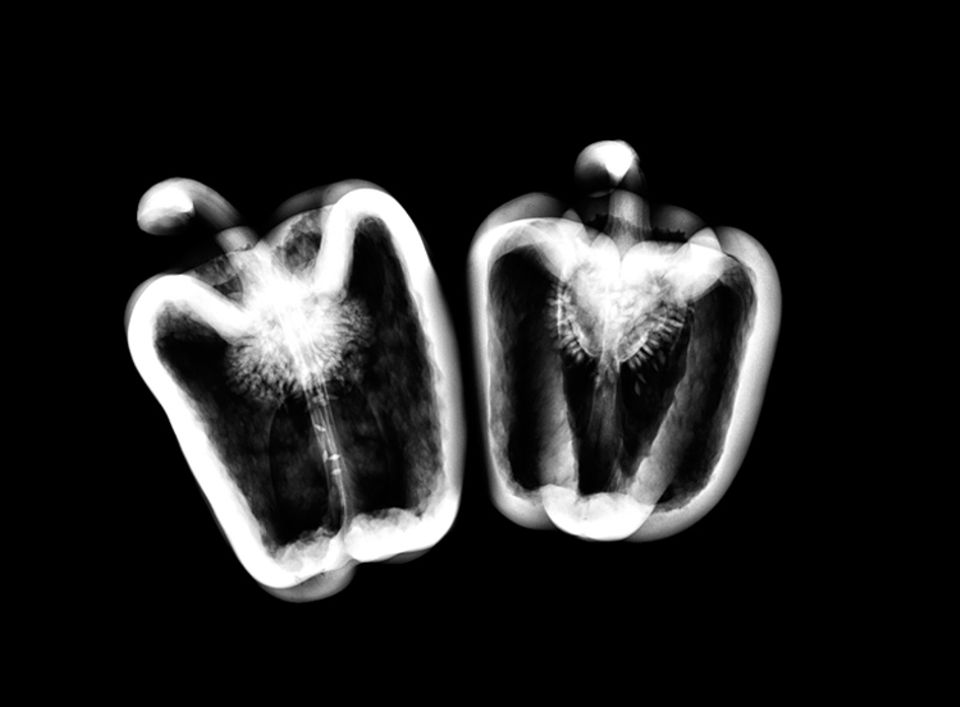 Röntgen: Röntgenstrahlung: Voller Durchblick - Bild 3