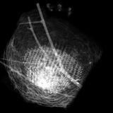 Röntgen: Röntgenstrahlung: Voller Durchblick - Bild 6