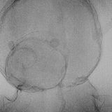 Röntgen: Röntgenstrahlung: Voller Durchblick - Bild 18