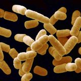 Weshalb finden Kontrolleure auf Fleisch so oft Keime?