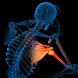 Gelenke: Wirksam gegen Rheuma