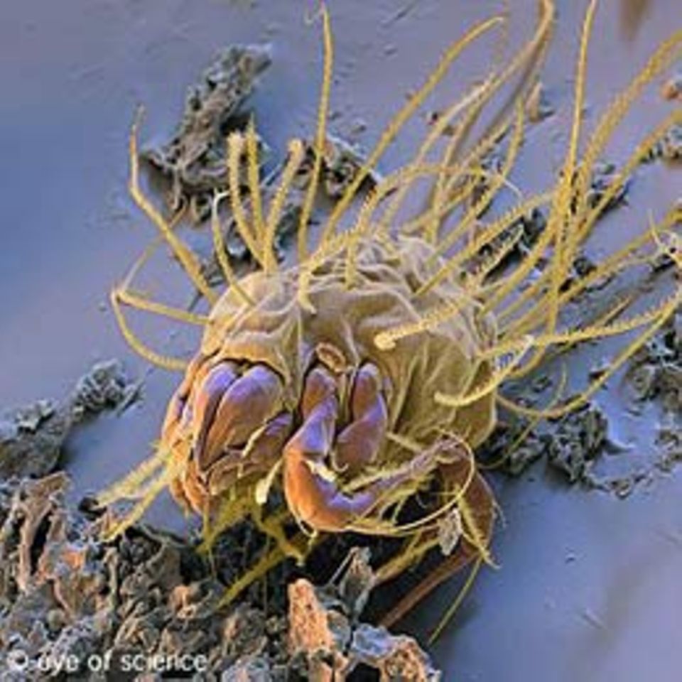 Parasiten: Wanzen, Milben, Zecken: Wer auf uns so alles wohnt Parasiten: Wanzen, Milben, Zecken: Wer auf uns so alles wohnt
