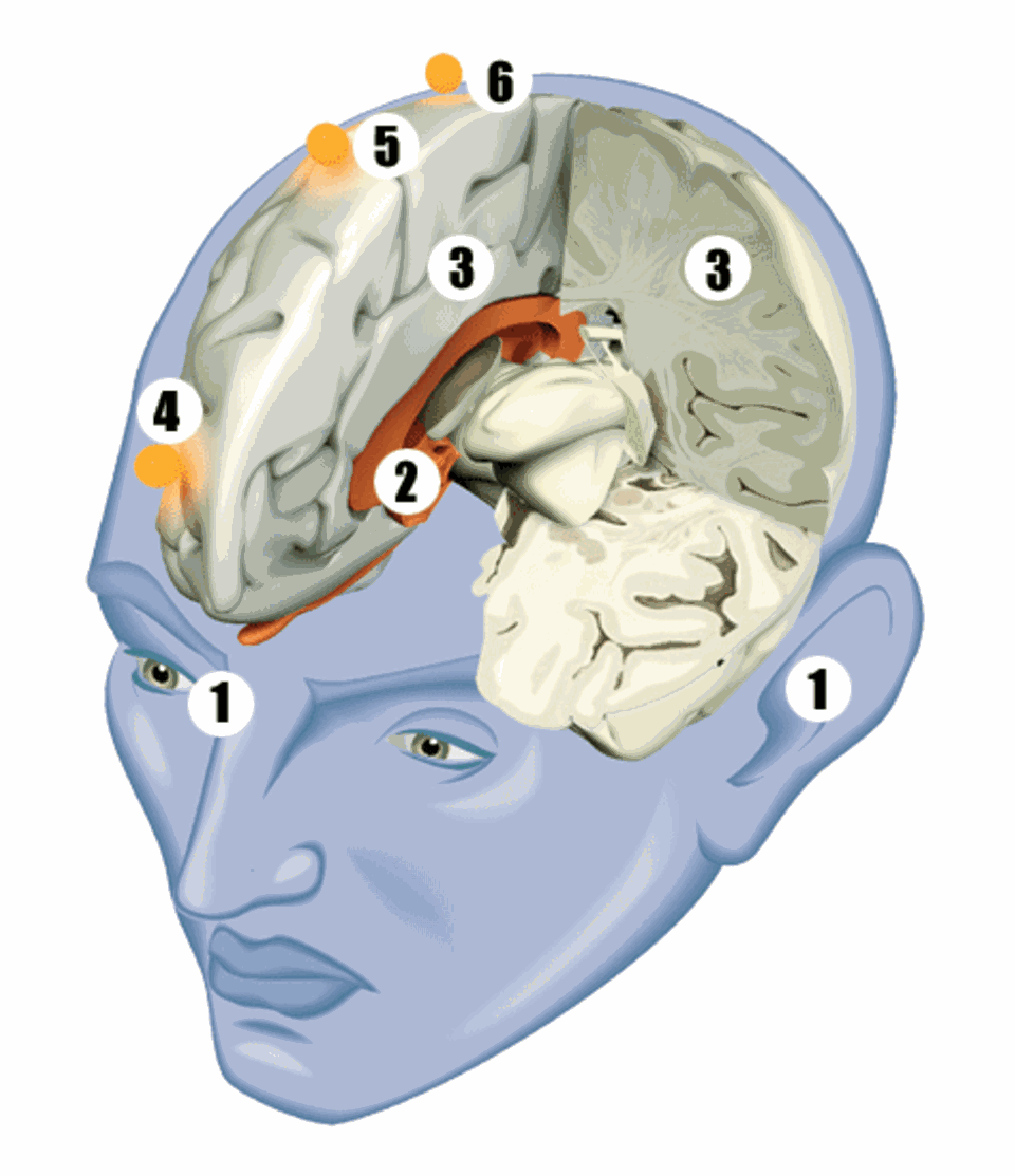 Das Gedächtnis: So gelangen die Erinnerungen in unser Langzeitgedächtnis: Alles, was wir sehen (1) oder hören, erreicht über Nervenleitungen das limbische System. Das ist wie ein Band um den so genannten Balken gespannt (2). Zuerst prüft es, was ihm wichtig und was ihm unwichtig erscheint. Das Wichtige schickt es weiter an die Großhirnrinde (3), die äußere Schicht des Gehirns: Das Gesicht einer Freundin vielleicht hinter die Stirn (4). Das leckere Frühstück etwa (5) und die Urlaubserinnerungen (6) nach rechts hinten. Von diesen Speicherstellen werden die Erinnerungen dann bei Bedarf wieder abgerufen.