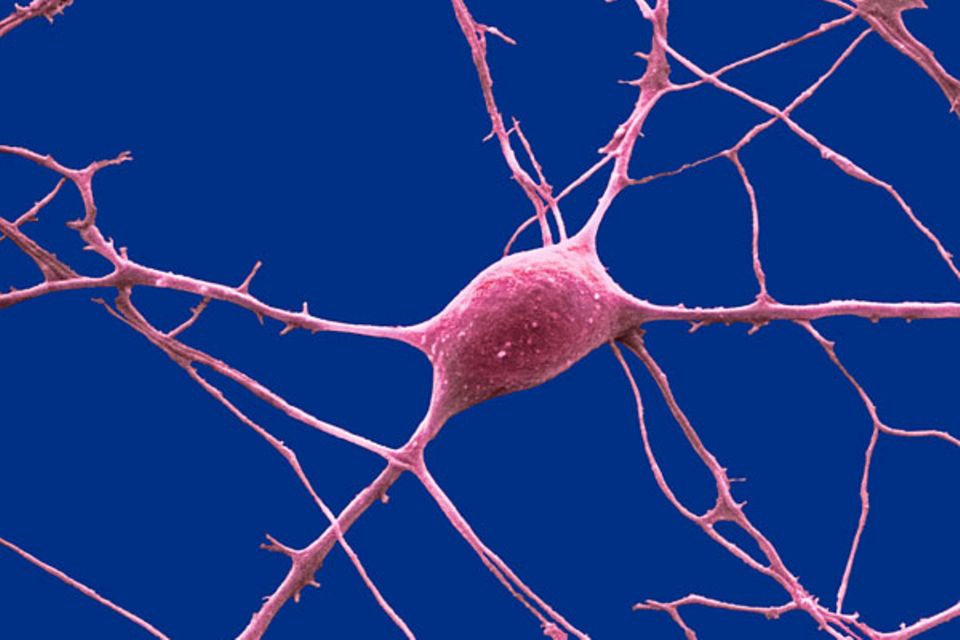 Was Nerven so tun: "Purkinjezellen" im Kleinhirn helfen uns, das Gleichgewicht zu halten