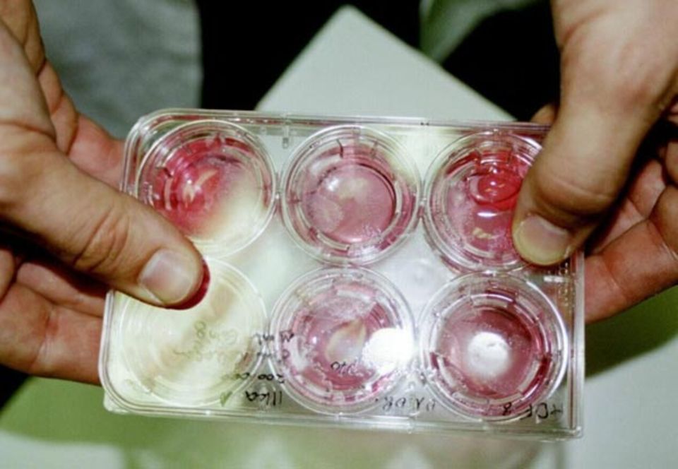 Tierversuche: In diesen Kunststoffgefäßen wachsen Hautzellkulturen. Auch mit solchen Kulturen kann die Ätzwirkung von bestimmten Stoffen festgestellt werden - Tiere müssen dafür nicht mehr leiden