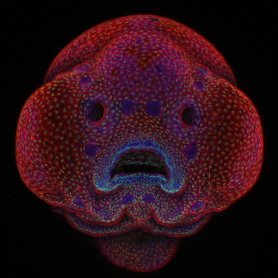 1. Platz: Zebrabärbling-Embryo