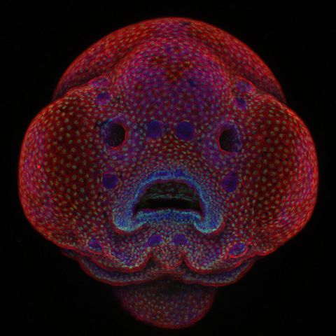 1. Platz: Zebrabärbling-Embryo