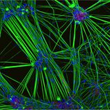 Nikon Small World 2016