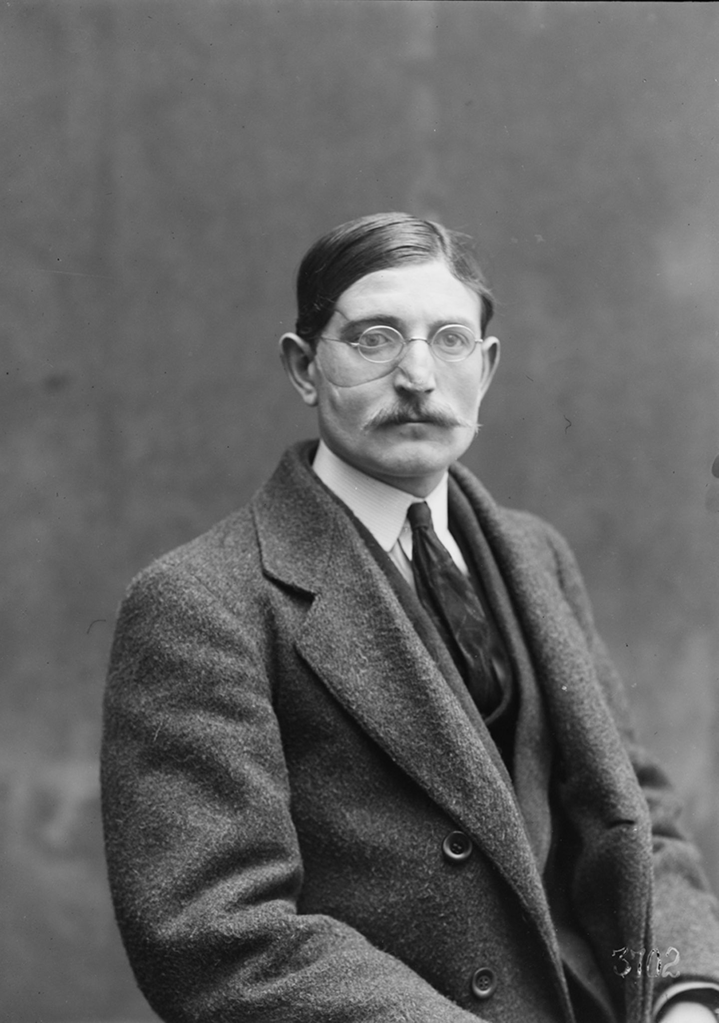 Mrs. Ladd, Gesichtsprothesen