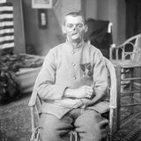 Mrs. Ladd, Gesichtsprothesen