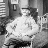 Mrs. Ladd, Gesichtsprothesen