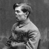 Mrs. Ladd, Gesichtsprothesen