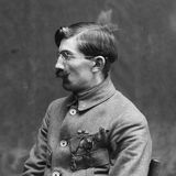 Mrs. Ladd, Gesichtsprothese