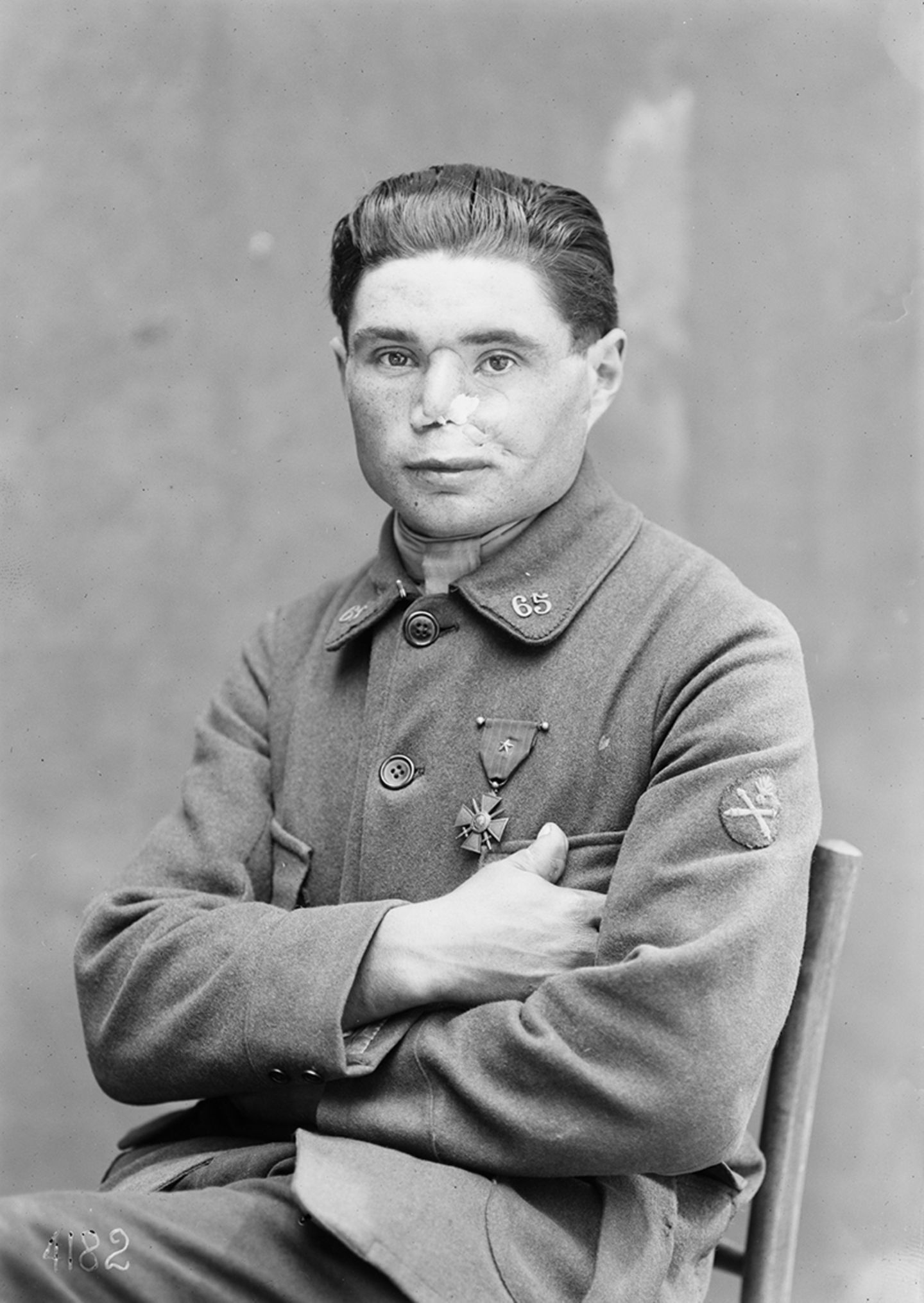 Mrs. Ladd, Gesichtsprothese