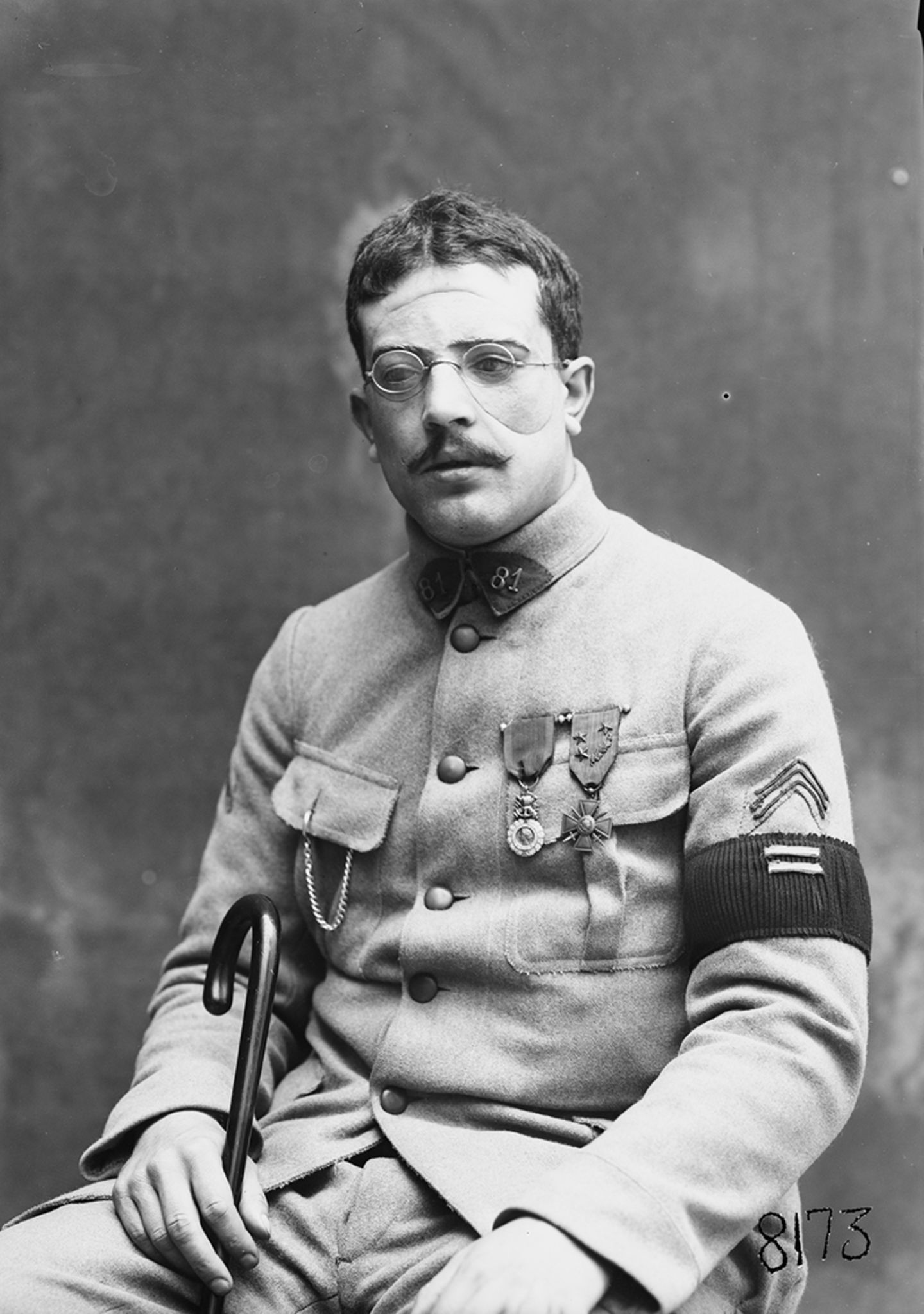 Mrs. Ladd, Gesichtsprothesen