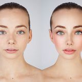 Selfie Harm by Rankin