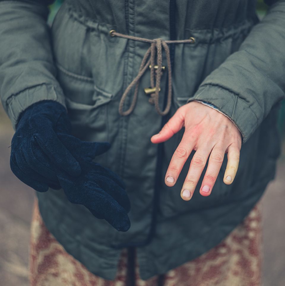 Raynaud Erkrankung