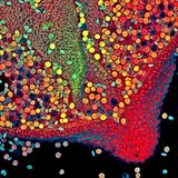 Preisgekrönte Bilder: Klein, aber spektakulär: Zehn Highlights der Mikroskop-Fotografie - Bild 6