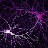 Preisgekrönte Bilder: Klein, aber spektakulär: Zehn Highlights der Mikroskop-Fotografie - Bild 9