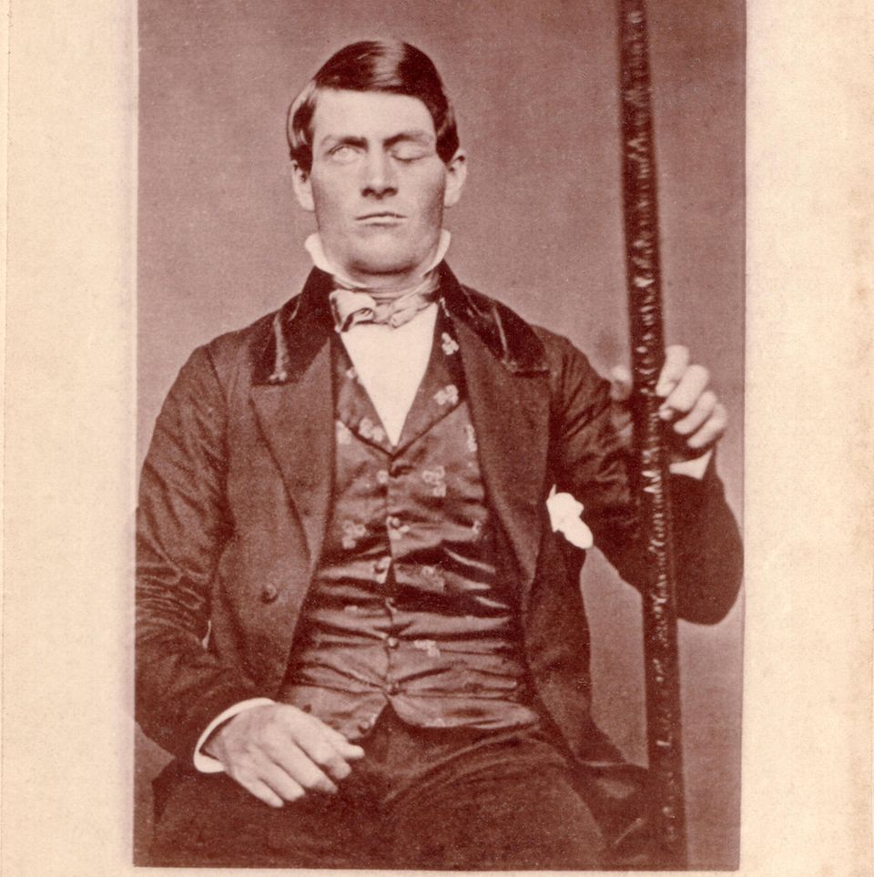 Phineas Gage