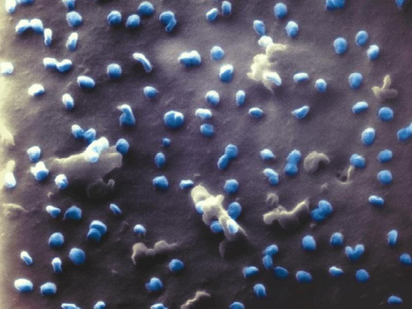 Coronaviren unter dem Mikroskop