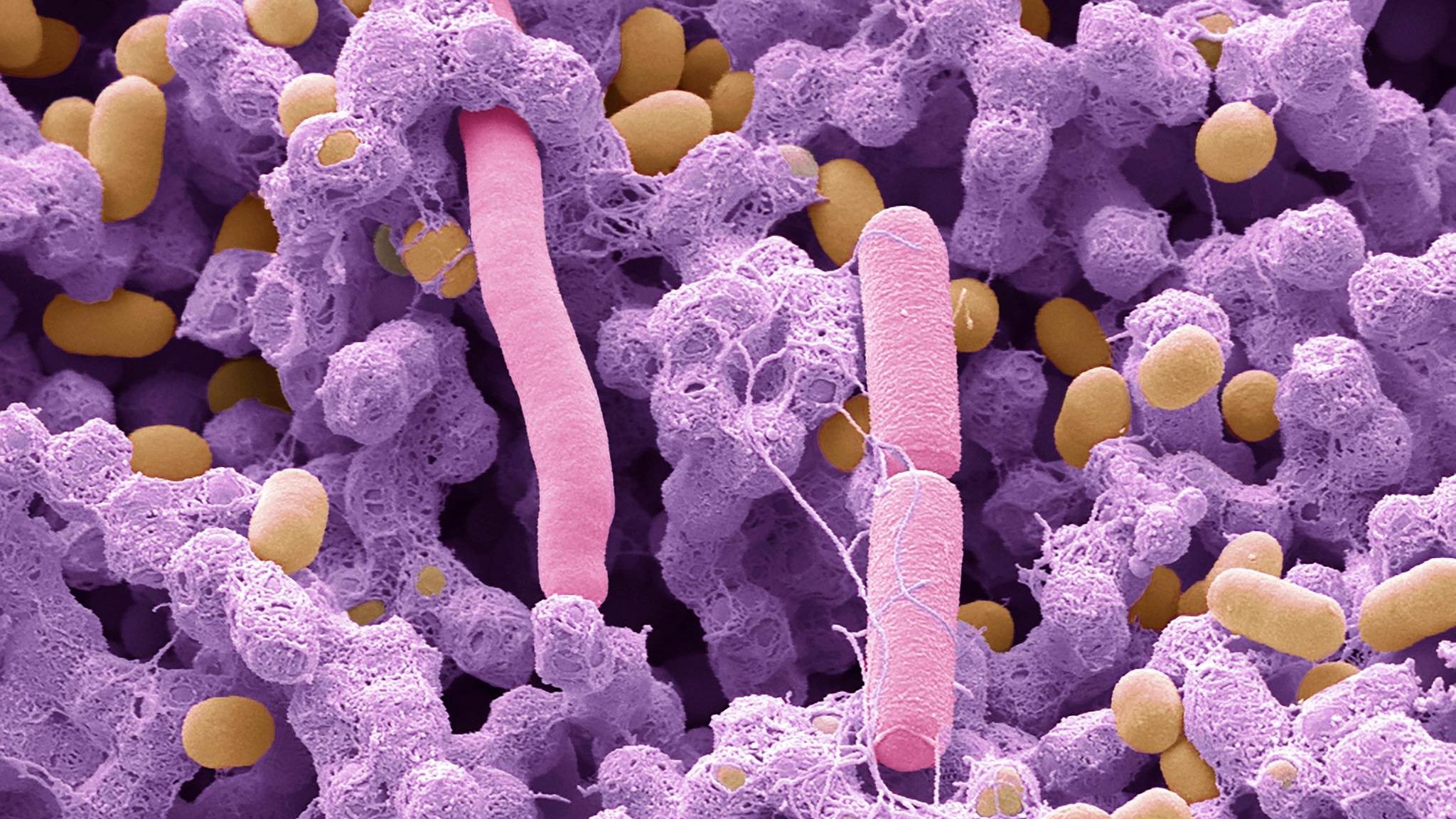 Ganz die Mutter? Gerade einmal vier Tage alt war der Produzent dieses menschlichen Stuhlgangs. In den ersten Lebensmonaten ähnelt das Mikrobiom des Babys zwar dem der Mutter. Trotzdem ist die Zusammensetzung bei jedem Menschen einzigartig